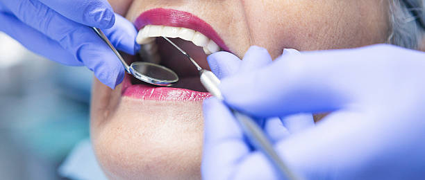 Best Emergency Treatment for Toothache in Perkasie, PA